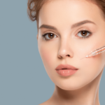 Botox London